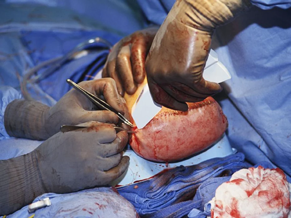 surgery