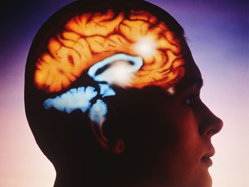 Head Injury, Alzheimer's Appear to Affect Brain in Similar Ways