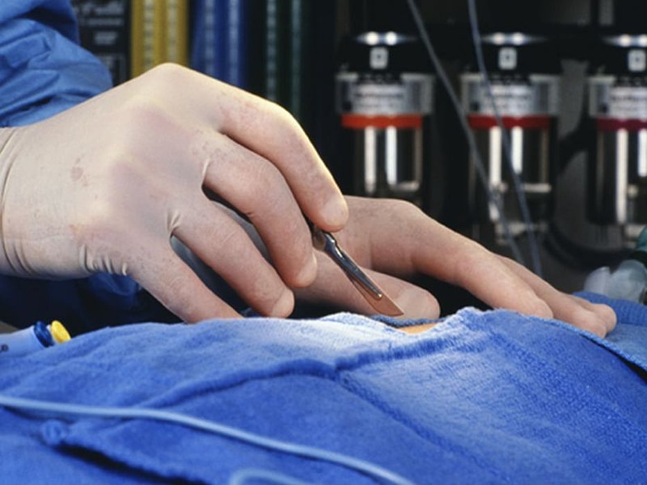 surgery