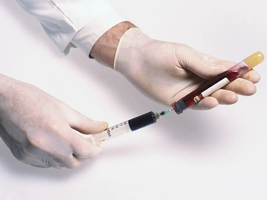blood sample