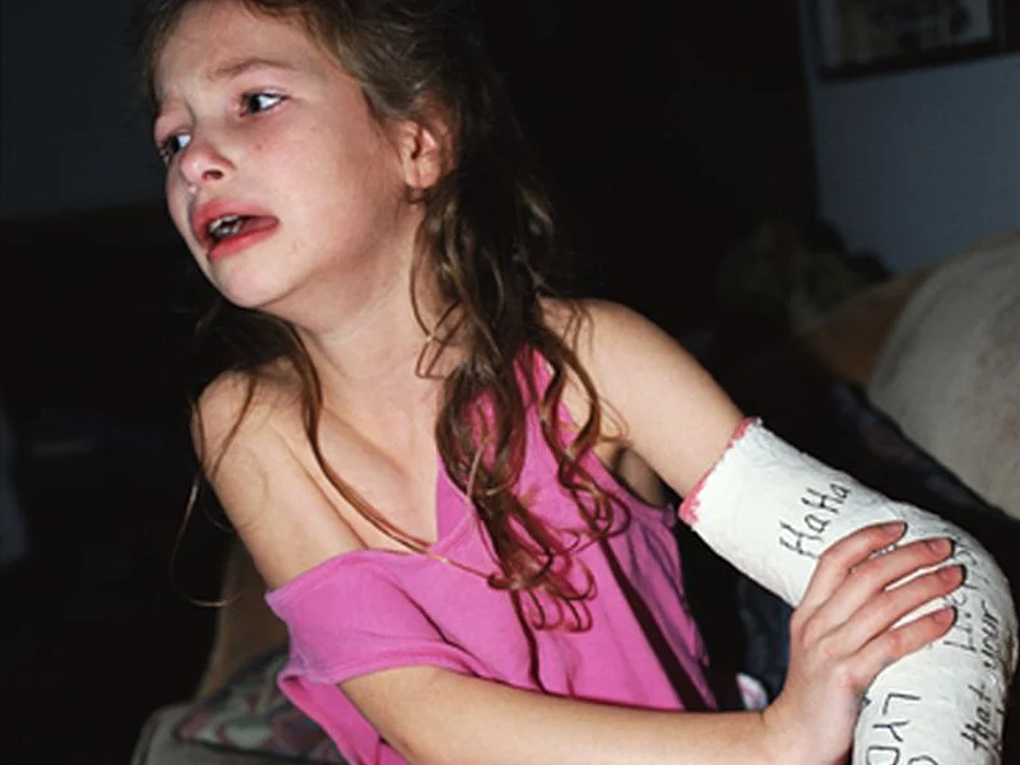 girl with a broken arm
