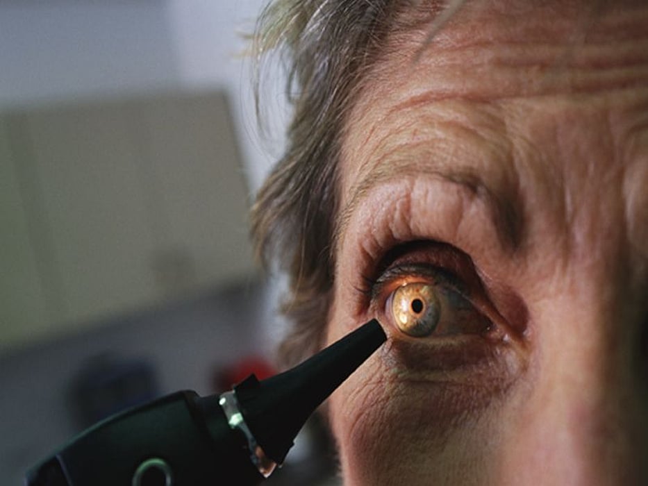 eye exam