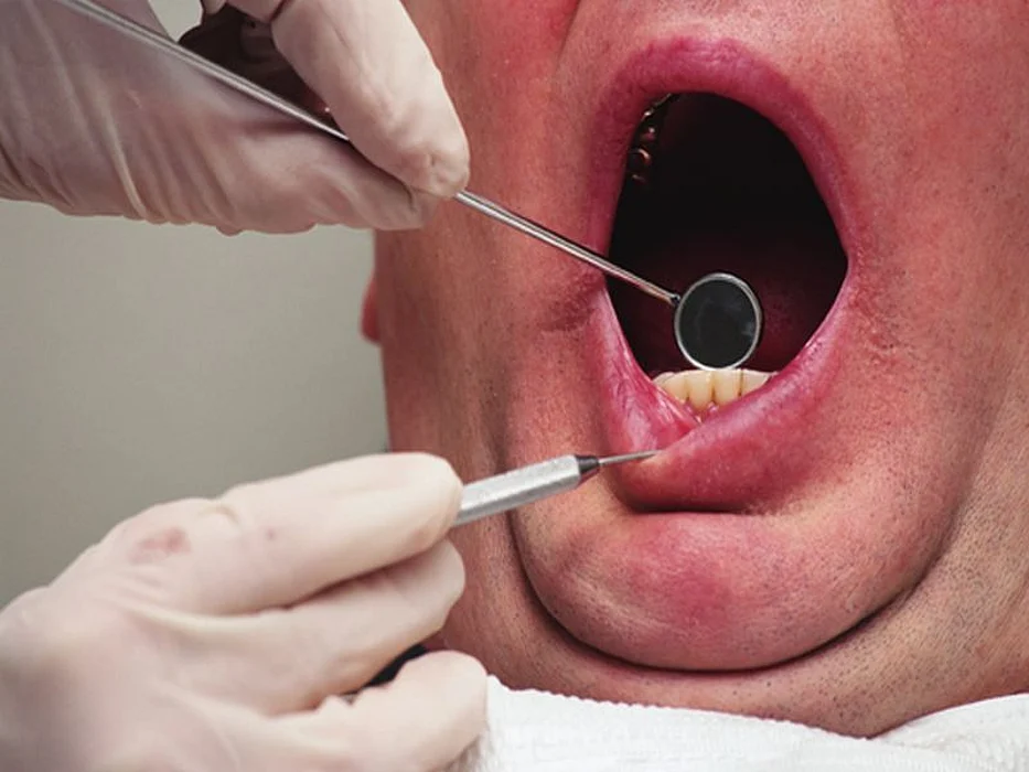 dental exam