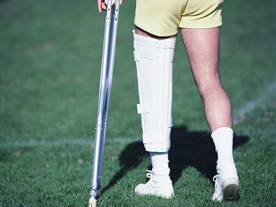 man with broken leg