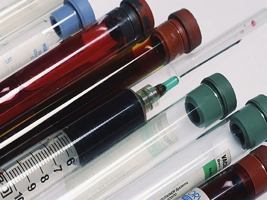bloodwork