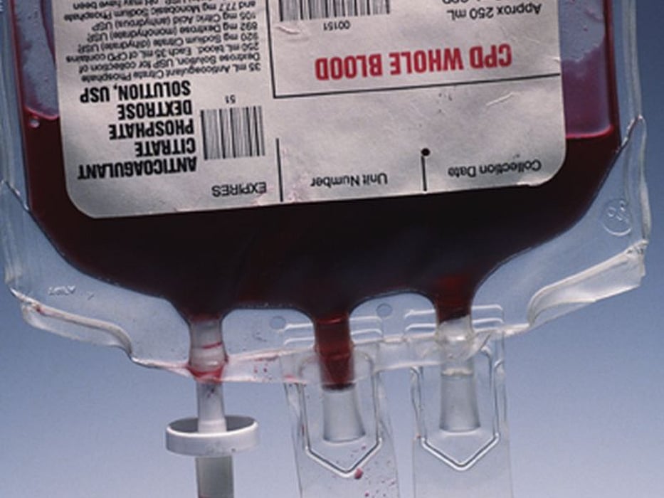 blood sample