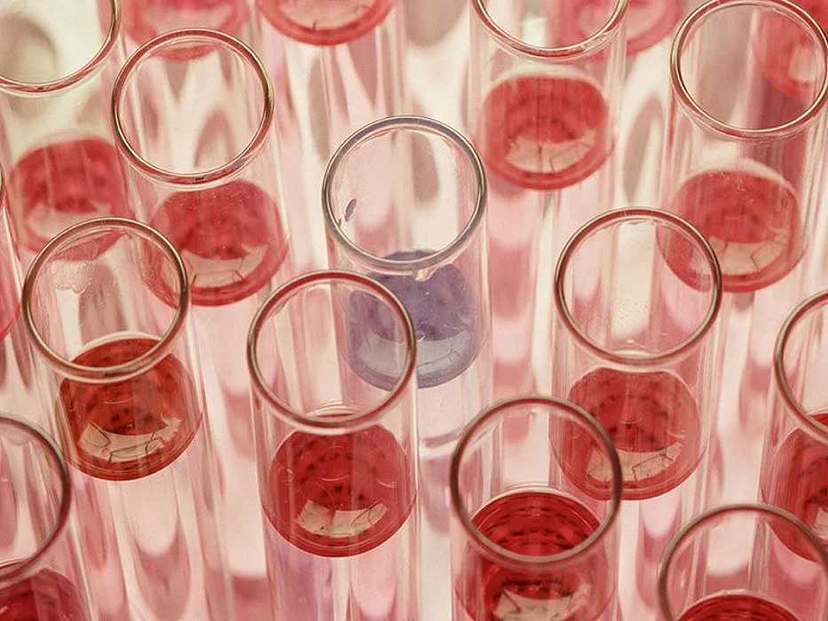 test tubes
