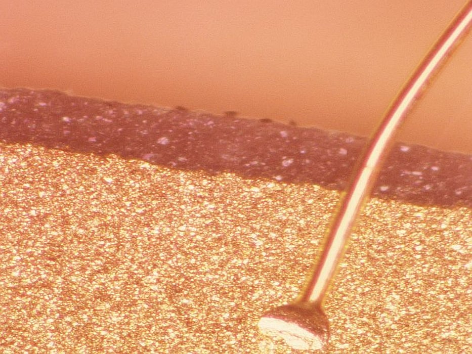 hair in skin