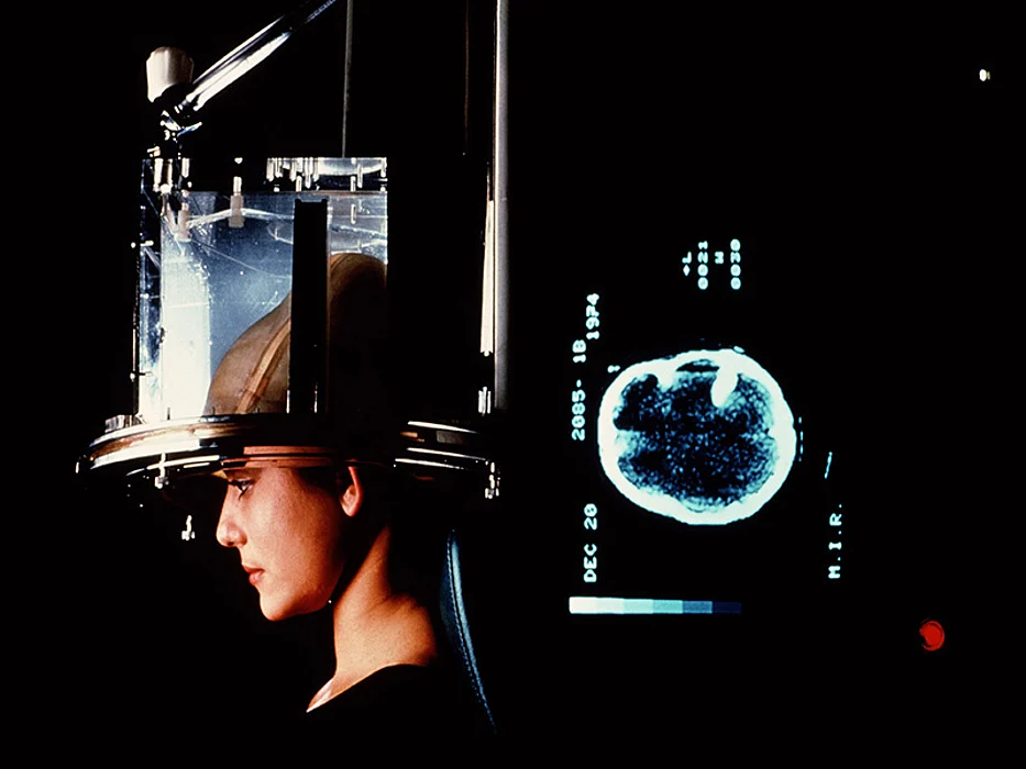 brain scan