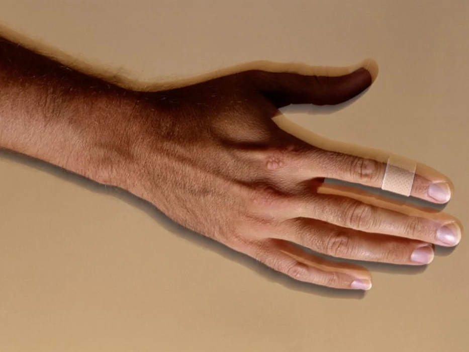 hand bandage
