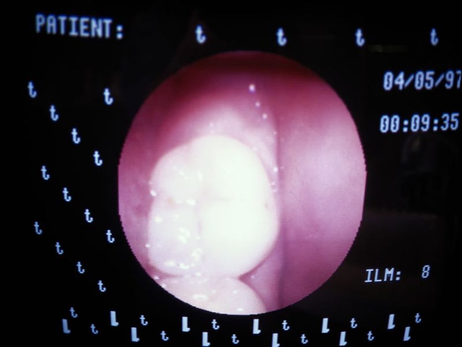 Tooth
