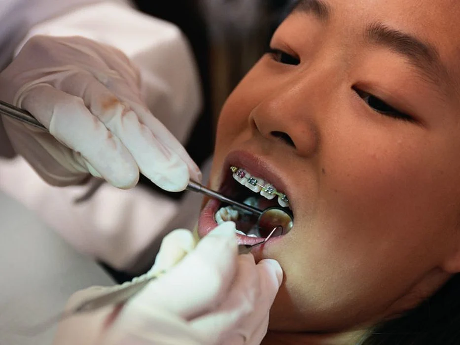oral braces