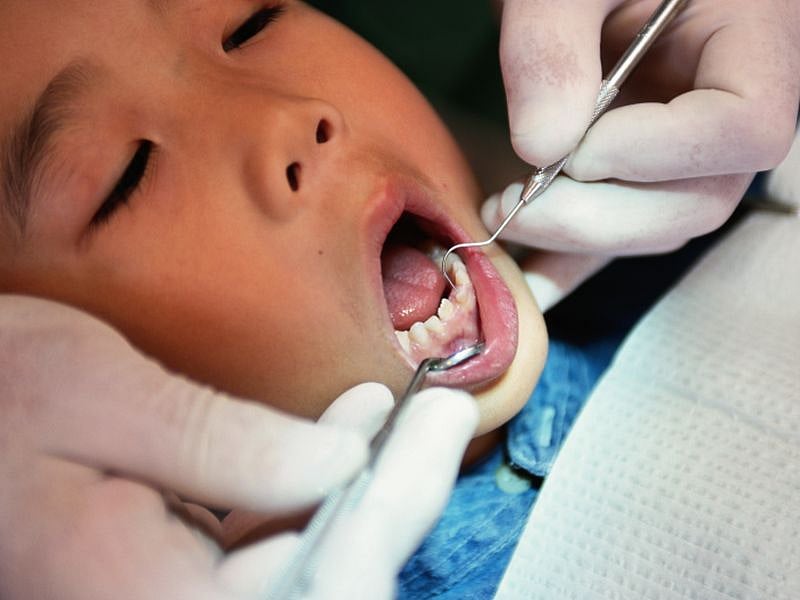 News Picture: Visiting a 'Dental Fear' Clinic Can Help Improve a Child's Smile