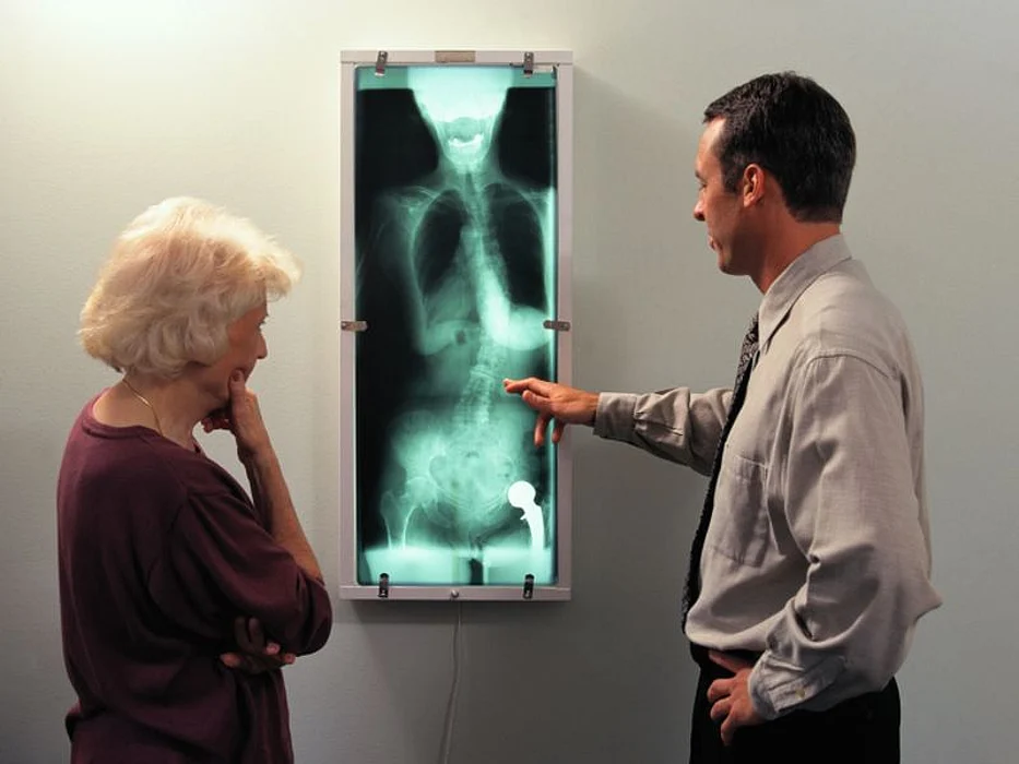 spinal xray