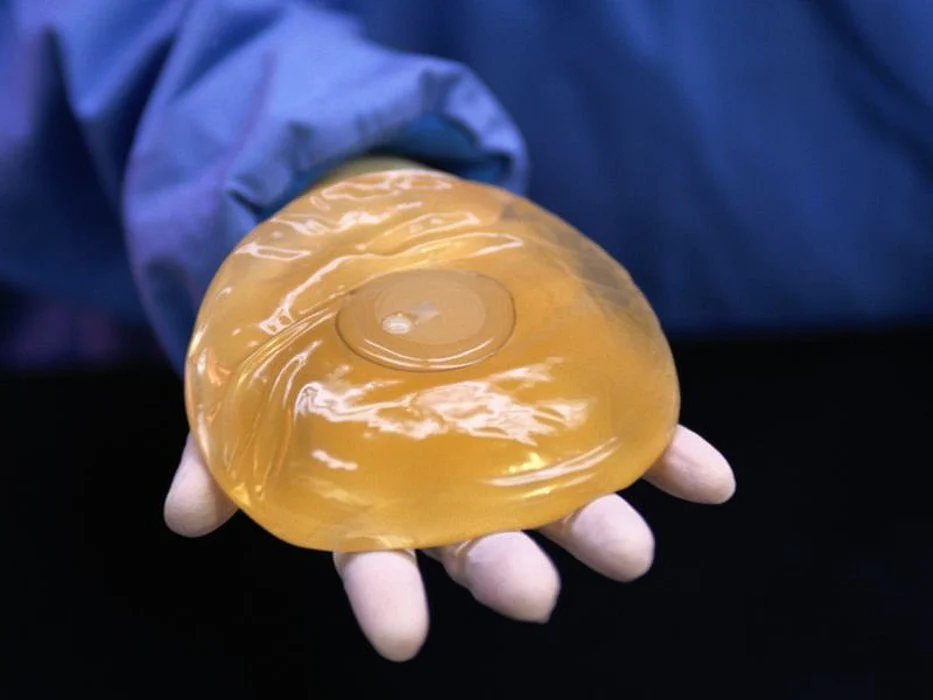 breast implant