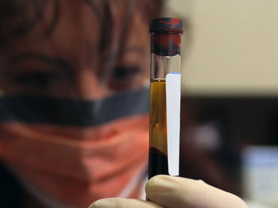 blood sample