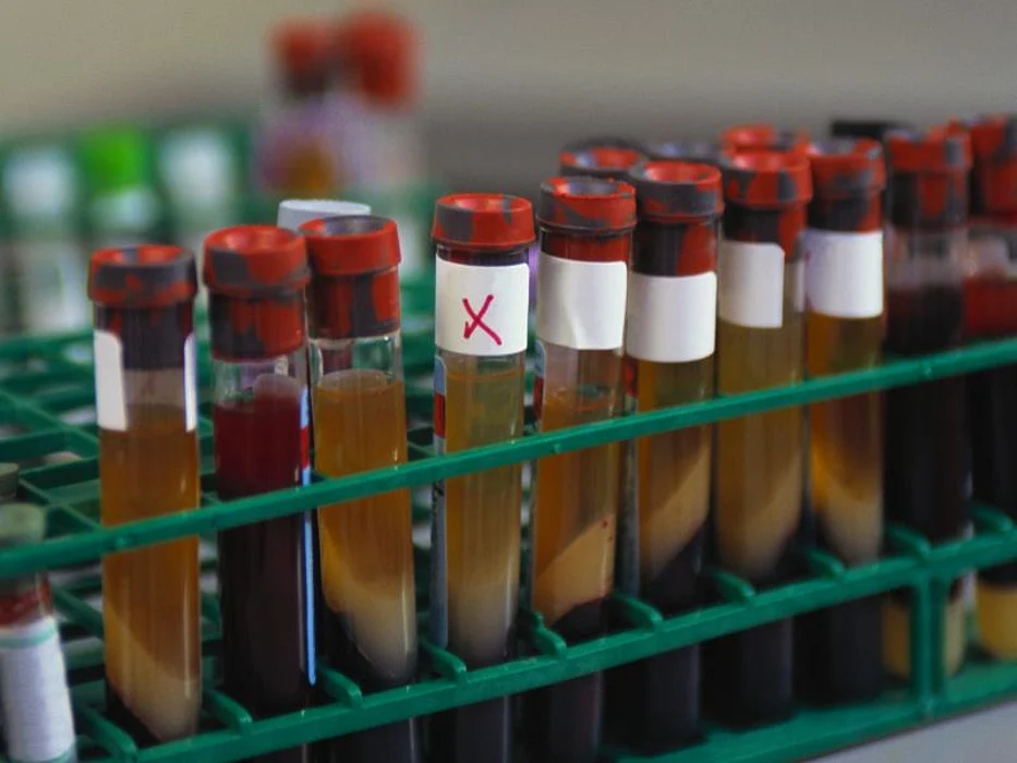 blood sample
