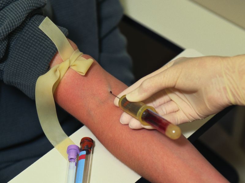 What You Need to Know Before Your Next Blood Test - Consumer Health News | HealthDay