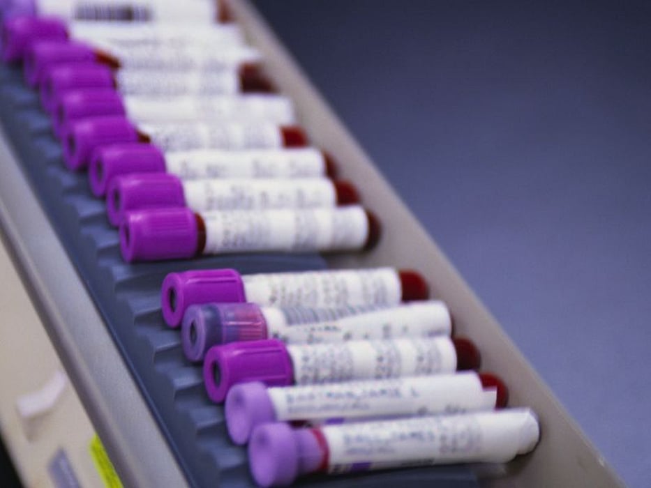 blood samples