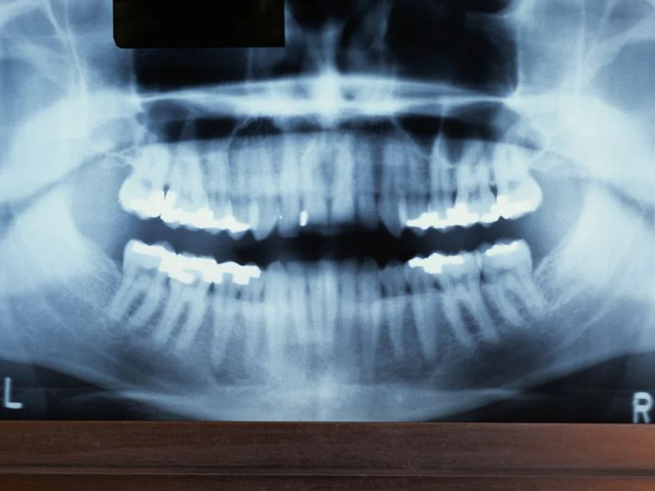 dental xrays