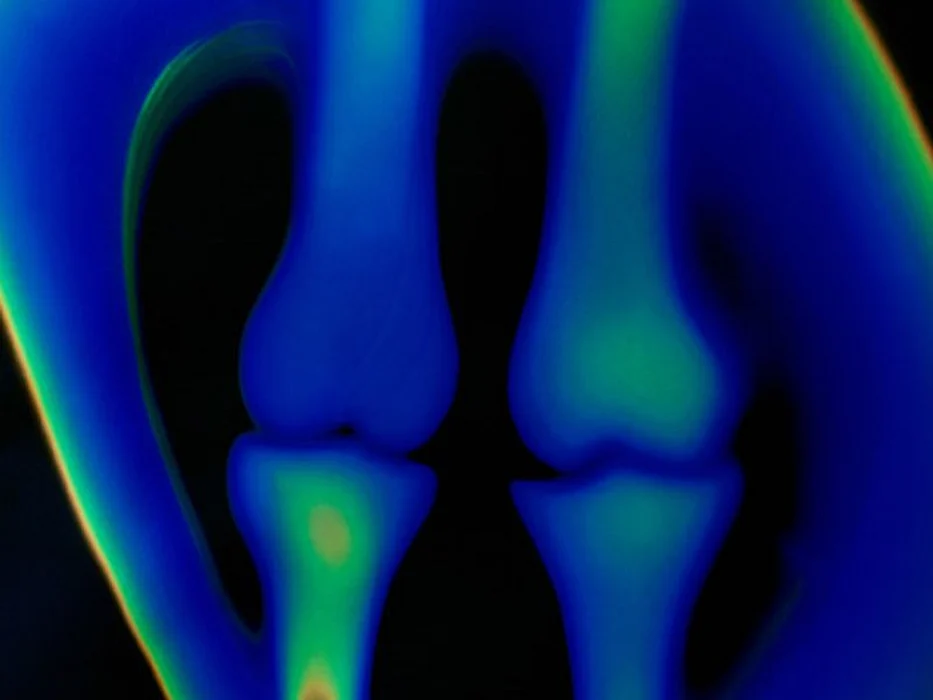 bones x-ray