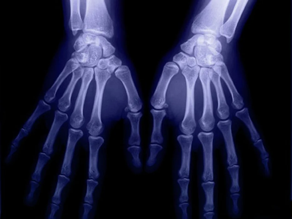 hand x-ray