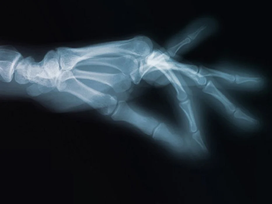 hand x-ray