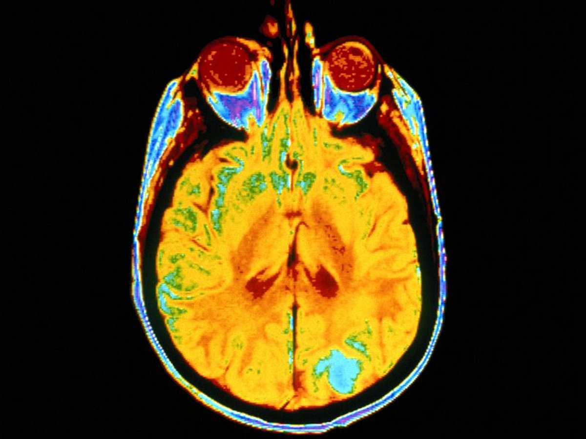 how to read mri images of the brain
