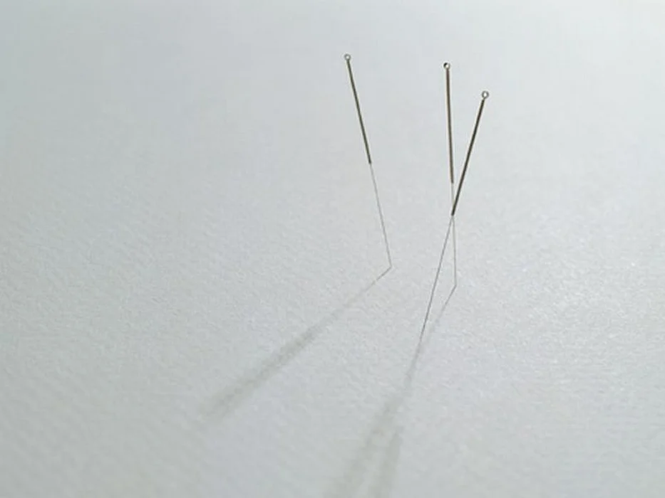 acupuncture needles