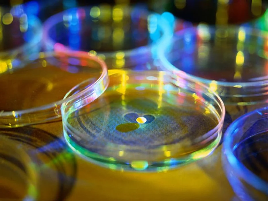 petri dish