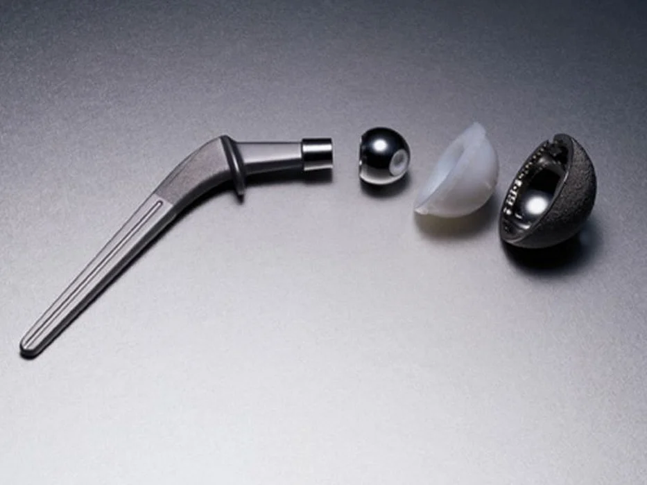 hip replacement