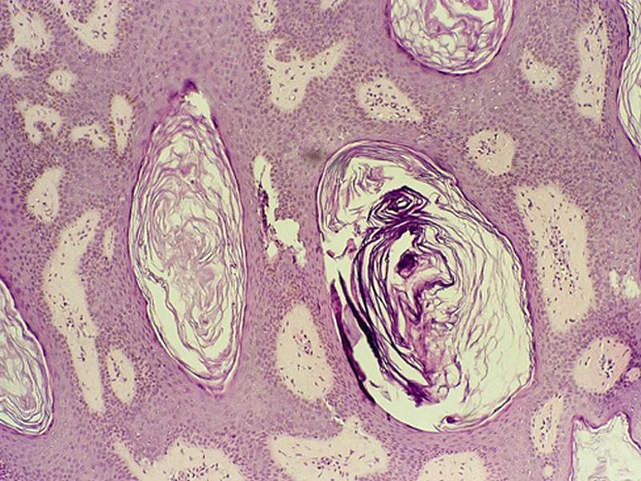 microscopic cells