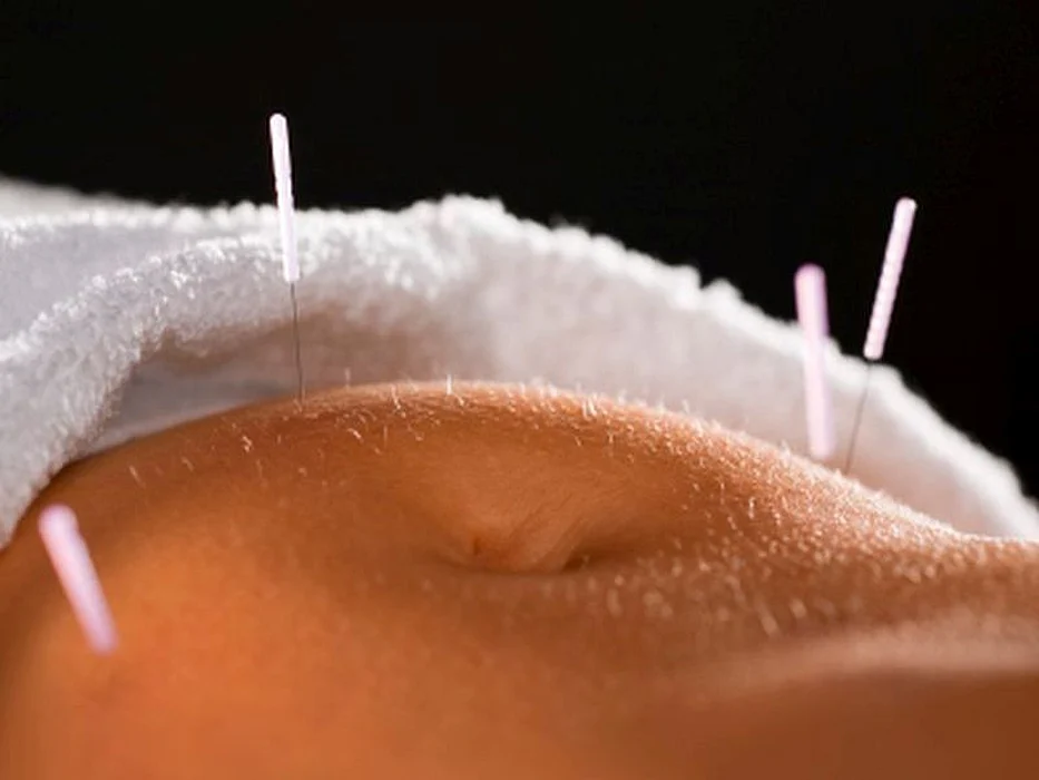 acupuncture stomach