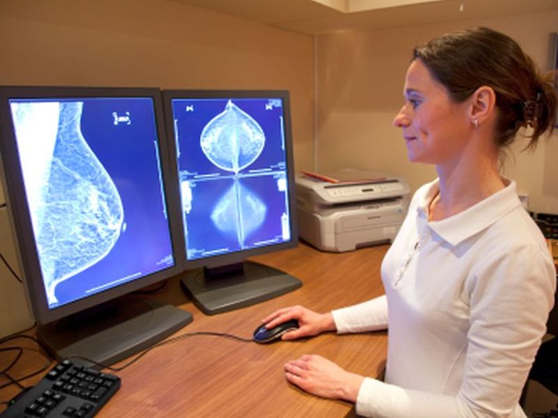Breast Cancer Surpasses Lung Cancer as Leading Cancer Diagnosis Worldwide