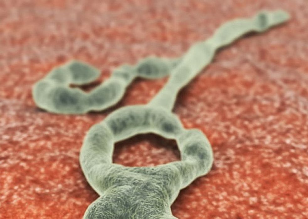 ebola virus