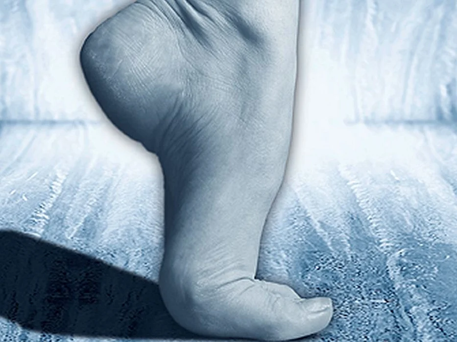 stretching foot