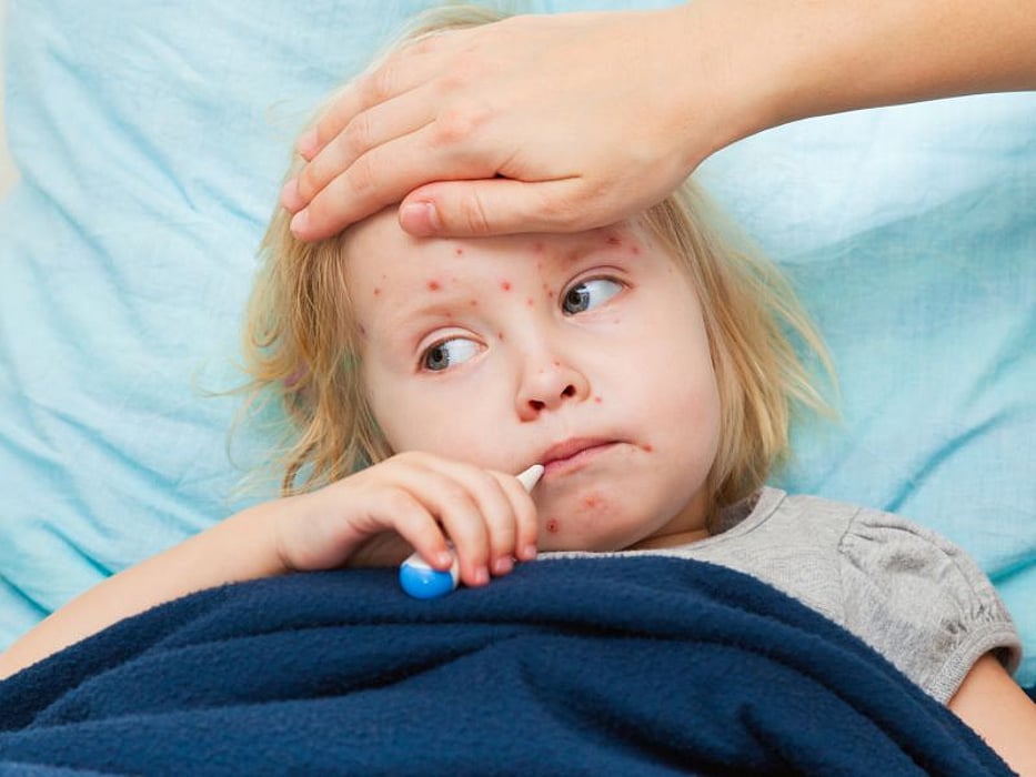 child with fever