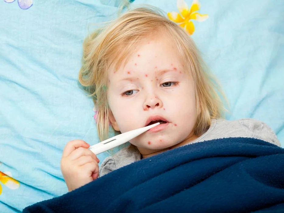 child with fever