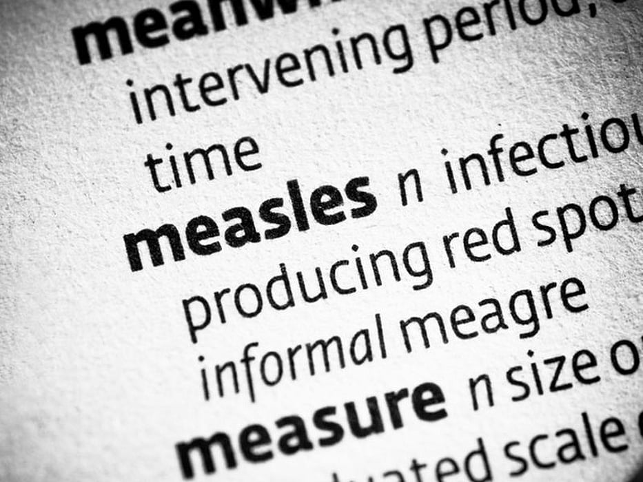 measles