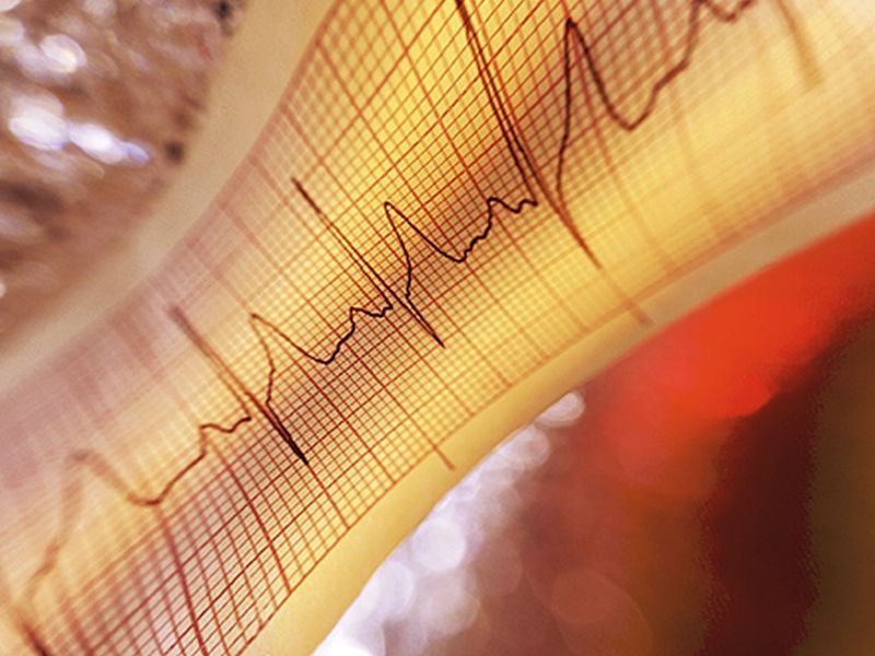 Blind People Are Better at Sensing Their Heartbeats
