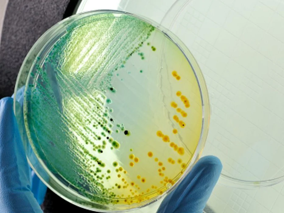 bacteria