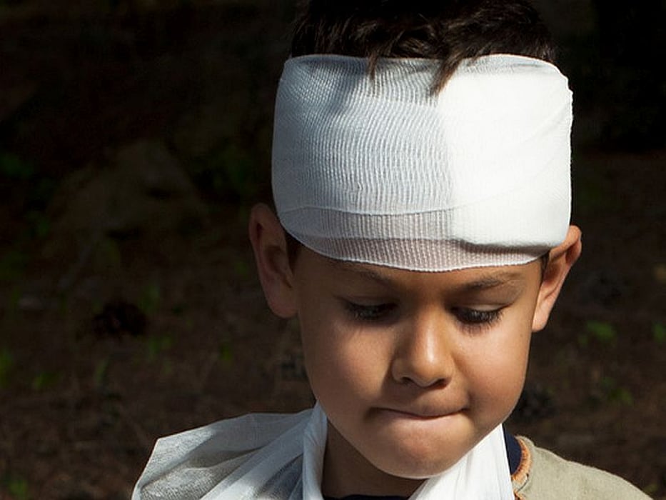 child\'s head injury