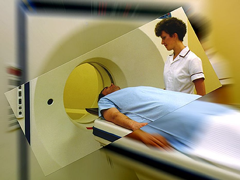 cat scan