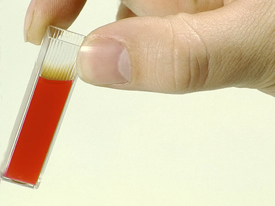 blood specimen