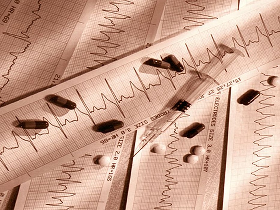 heart scan