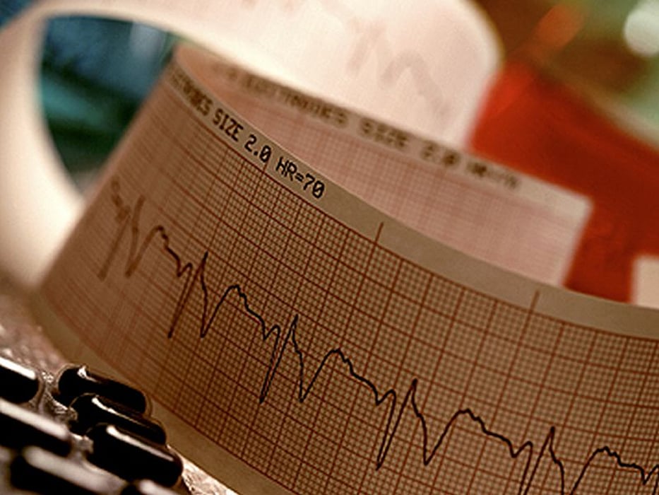 heartbeat scan