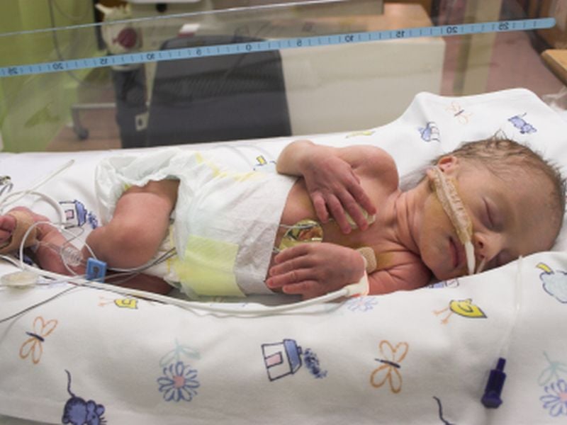 Preemie Babies End Up Hospitalized More as Kids