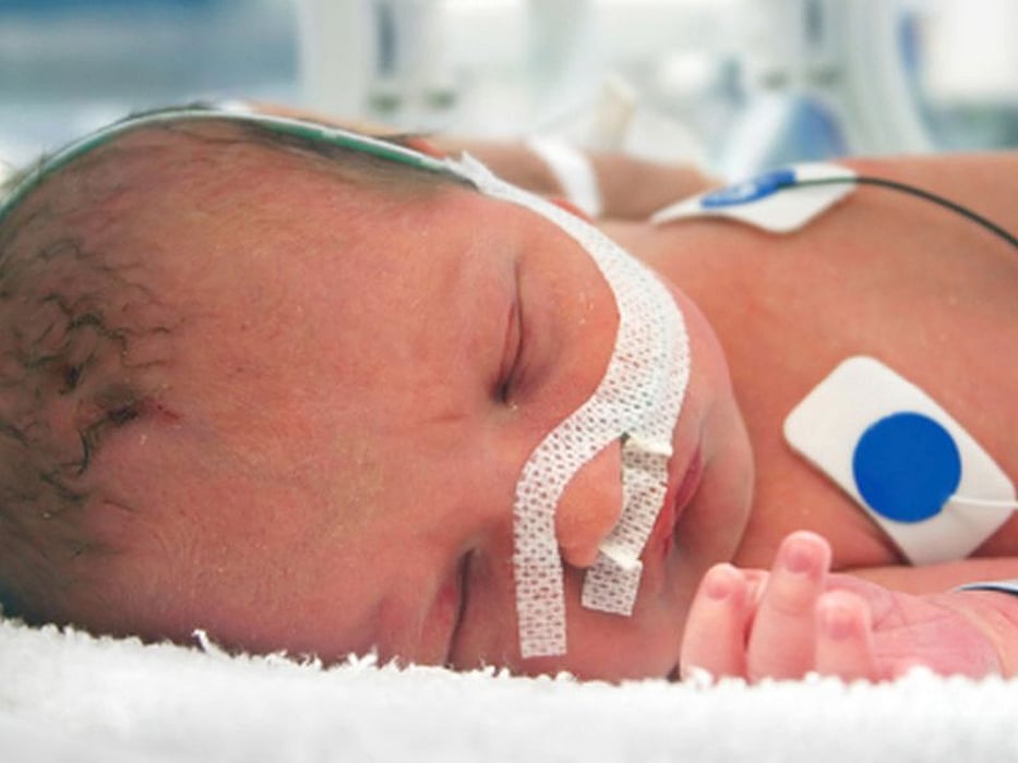 premature infant