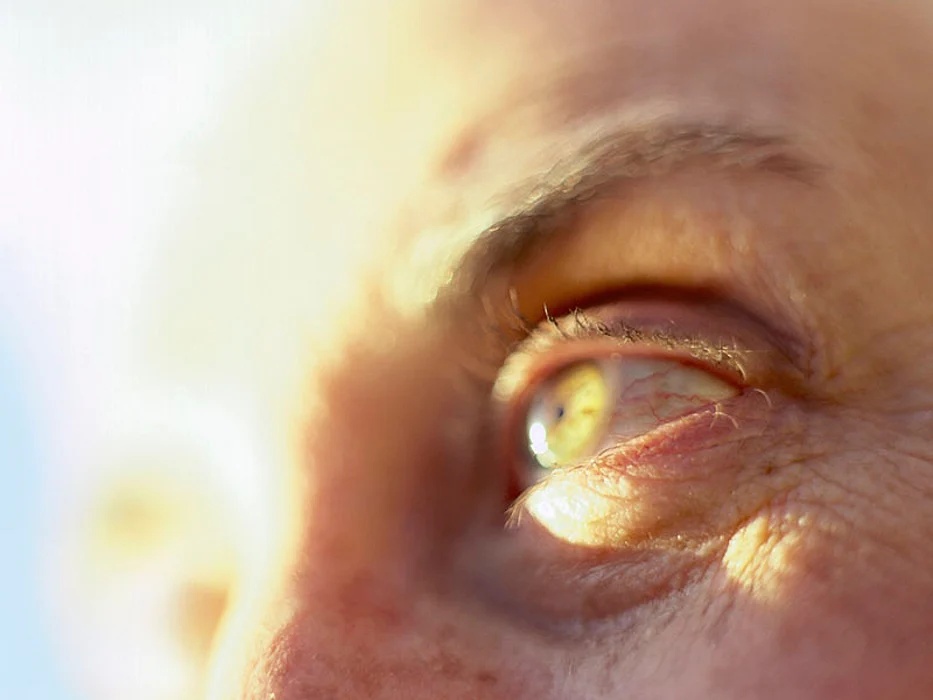 eyeball