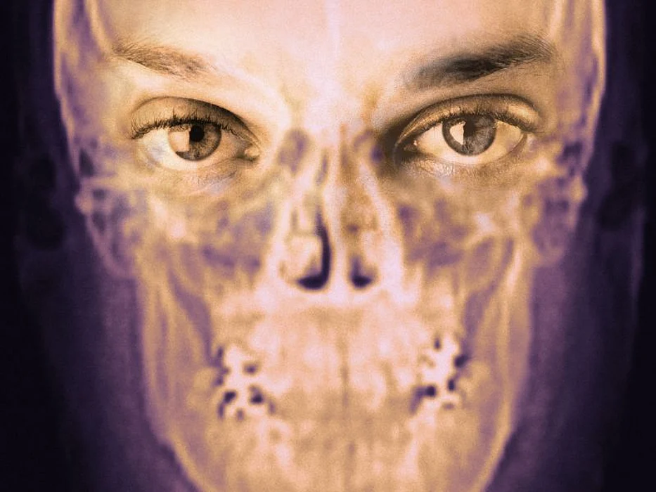 skull